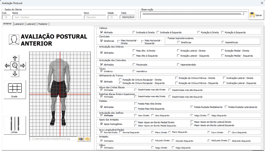 planilha de avaliação postural